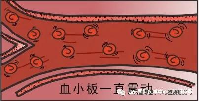 【科普】血小板是正常值的三倍？專(zhuān)家提醒小心血栓和出血！