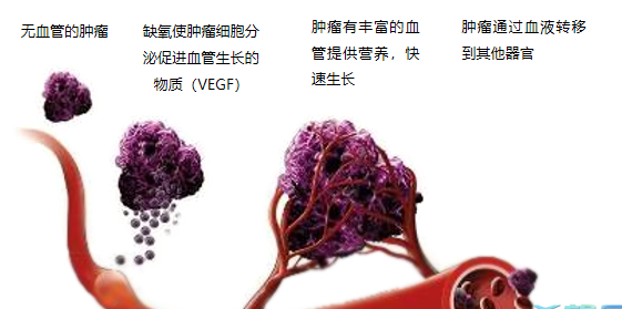 晚期腫瘤為什么會復(fù)發(fā)轉(zhuǎn)移？