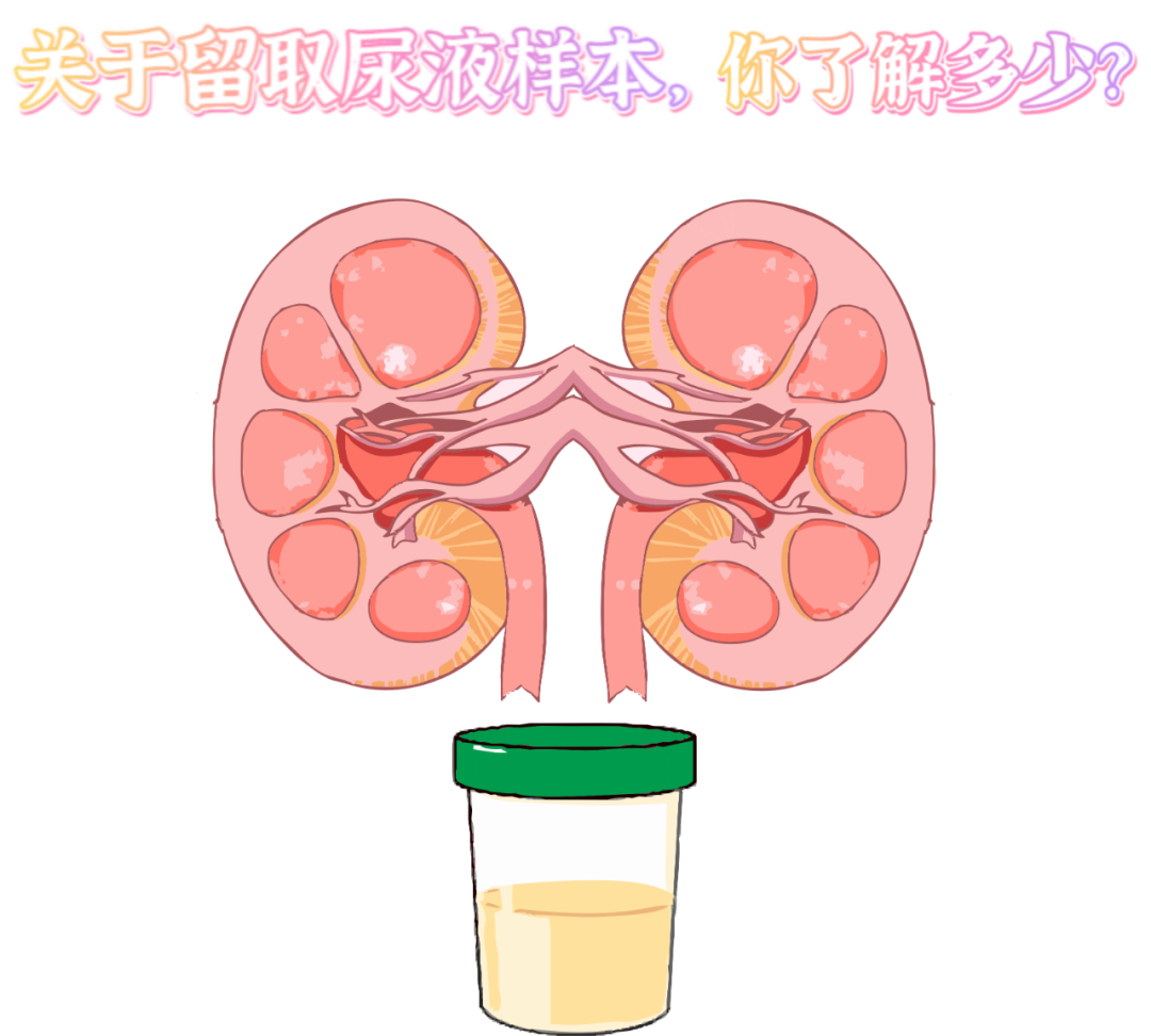 做尿檢，不得不說的注意事項(xiàng)！