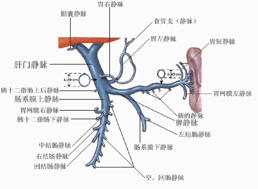 反復(fù)嘔血、黑便怎么辦？TIPS手術(shù)能解決