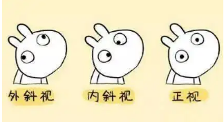 小baby老歪著頭？警惕斜頸! 這樣糾正……