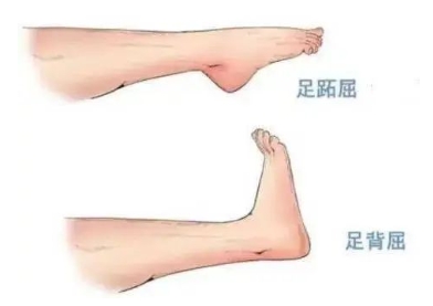 扭胯小連步、動(dòng)感搖花手……“科目三”雖火，運(yùn)動(dòng)損傷也要防！